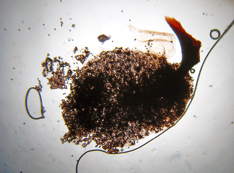 Lamproderma ovoideumechinulatum ?